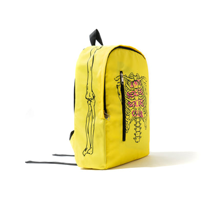 Broken Yellow Backpack